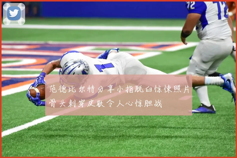 范德比尔特分享小指脱臼惊悚照片骨头刺穿皮肤令人心惊胆战
